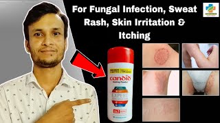 Candid Dusting Powder Use in Hindi  Clotrimazole Powder  Best Anti fungal Powder  SK MEDICINE [upl. by Shererd245]