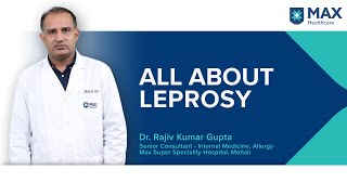 All about Leprosy  Max Hospital [upl. by Enelegna]