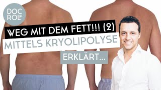 KRYOLIPOLYSE BEHANDLUNG – Fett weg Teil 2 mit Dr Rolf Bartsch [upl. by Savart]