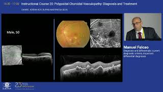 4 Diagnosis and differentials current diagnostic criteria important differential diagnoses [upl. by Inot]