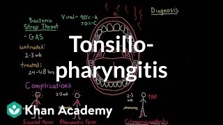 Tonsillopharyngitis  Complications diagnosis and treatment  NCLEXRN  Khan Academy [upl. by Ydoow]