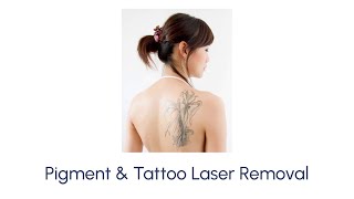 What to Know About Pigment amp Tattoo Laser Removal [upl. by Keeler161]