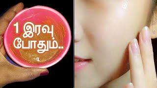 1 இரவில் முகம் வெள்ளையாக இது போதும்  face whitening tips in tamil [upl. by Okimat]