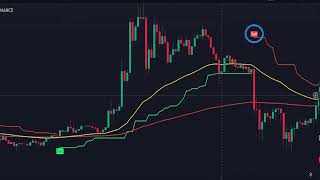 Best Supertrend Trading Strategy： Best Tradingview indicator 000 [upl. by Madora]