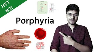 Porphyria  Biochemistry  HYT 21  NEETPG  INICET [upl. by Nordin]