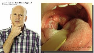 Sore Throat Approach [upl. by Anerul]