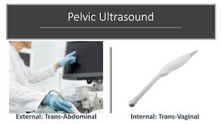 Female Pelvic Ultrasound  Key Info amp Preparation [upl. by Camroc]