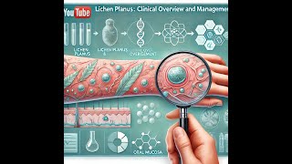 Lichen Planus Clinical Overview and Management [upl. by Zitella]