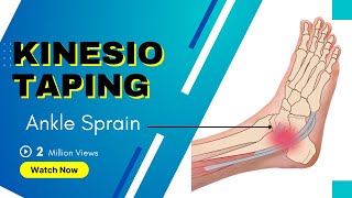 How to treat an Ankle Inversion Sprain  Kinesiology Taping to stabilise ligaments [upl. by Yerbua]