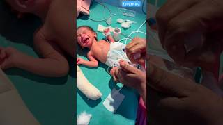 Very Emotional Crying ❤️medical newbornbaby viralvideo [upl. by Olette]