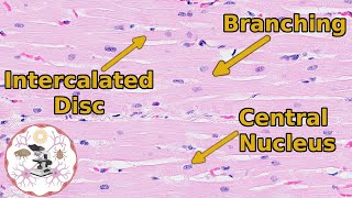 Heart Histology  Valveuable Insights [upl. by Idarb]