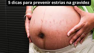 5 dicas para prevenir estrias na gravidez [upl. by Crispas425]