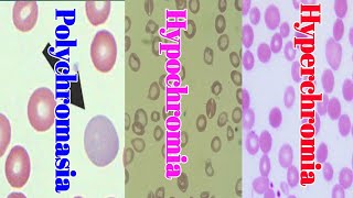 Hypochromia Hypochromia and polychromasia Blood Smear Examination blood smear Lecture 3 [upl. by Hahseram121]