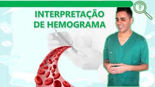 Interpretação de Hemograma  Série Branca PARTE 2 [upl. by Kilan43]