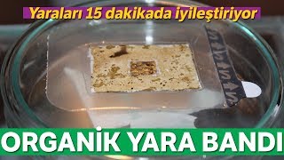 Yaraları 15 Dakikada İyileştiren Organik Yara Bandı Üretildi [upl. by Drucie]