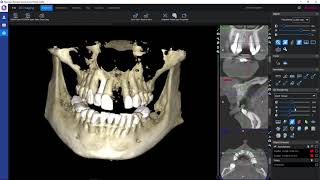 Korzystanie z przeglądarki Planmeca Romexis Viewer [upl. by Davina]