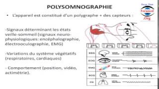 Comment Fonctionne Polysomnographie Polygraphie apnee du sommeil appareillage pour mieux dormir [upl. by Elinet255]