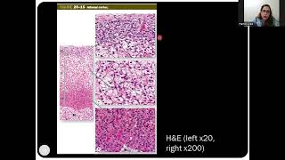 Histology of the Adrenal Suprarenal Glands [upl. by Neeruan889]