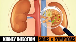 Kidney Infection Pyelonephritis Signs amp Symptoms [upl. by Nhabois]