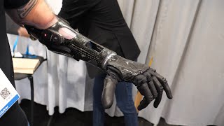 Psyonic  TouchSensing Bionic Ability Hand  Interview  CES 2022  Poc Network [upl. by Eineeuq]