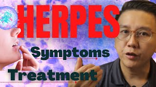 Herpes symptoms in female amp men  treatment explained [upl. by Eleaffar]