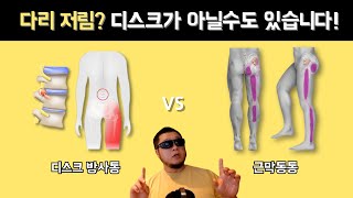 허리디스크가 아니라 근막동통일수도 있습니다 [upl. by Suirred]