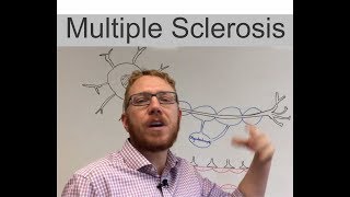 Multiple Sclerosis [upl. by Etnuhs]