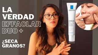 La VERDAD de EFFACLAR DUO de La Roche Posay Seca granos🆘controla el acné  Revelando ingredientes [upl. by Artimid529]