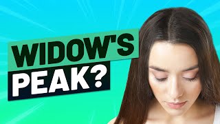 Widow’s Peak Hairline How To Treat It and What Causes it [upl. by Mecke729]