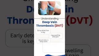 Deep Vein Thrombosis DVT  Deep Vein Thrombosis Treatment  Dr Nikhil Bansal  Jaipur [upl. by Oicnanev431]