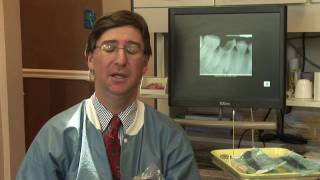 Tooth Abscess  Wisdom Tooth Abscess Symptoms [upl. by Hak]