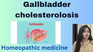 Gallbladder cholesterolosis treatment  Cholesterolosis symptomscauses amp Homeopathic medicine [upl. by Aihsined]