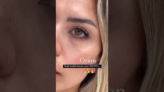 Renkli Lens CLARO ORİON  Optikzade [upl. by Oterol685]