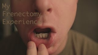 My Frenectomy Experience [upl. by Bloom421]