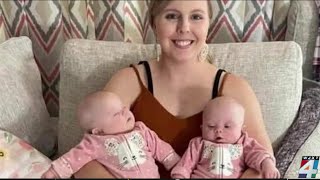 Local twins with Down syndrome inspiring others [upl. by Nnauol]