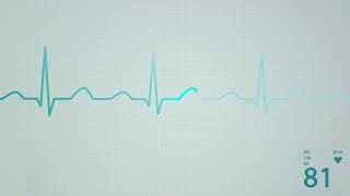 Decode WPW Syndrome Mastering ECG Delta Waves [upl. by Ligetti719]