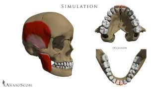 Personal Dental Model and Occlusion Simulation [upl. by Lj]