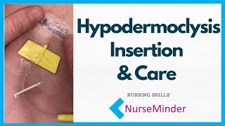 Hypodermoclysis Insertion and Care for Nurses [upl. by Ayita964]