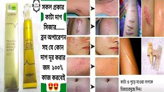 Lanbena TCM Scar And Acne Mark Removal Gelpricehow to use [upl. by Yetty585]