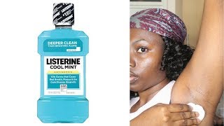 GUESS WHAT HAPPENED WHEN I APPLIED LISTERINE IN MY UNDERARM [upl. by Adnalay]