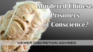 Are Plastinated Bodies Murdered Chinese Prisoners of Conscience  China Uncensored [upl. by Aeynod]