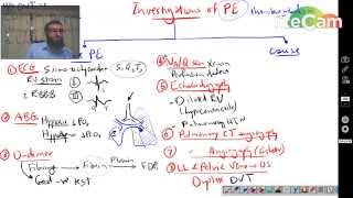 Pulmonary Embolism 1  Investigations [upl. by Nylesaj]