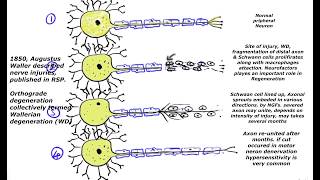 Wallerian degeneration regeneration process of nerve fiberaxon cut and progressive response [upl. by Hubey73]