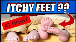 Why Do I Get Itchy FeetSkin at Night  How To Get Rid of ITCHY FEET [upl. by Carleen]