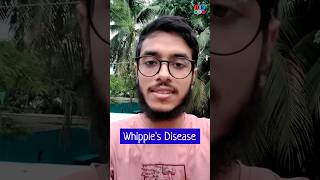 Whipples disease  Malabsorption syndrome  Pathology Medicine Surgery  Dr Med [upl. by Elokin]