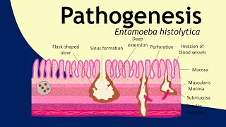 Pathogenesis of Entamoeba histolytica  parasitology  Basic Science Series [upl. by Abdu]