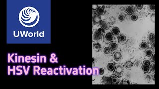 Kinesin amp HSV Reactivation  USMLE UWorld Nervous System [upl. by Nojram]