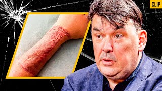 What They HIDE About HORRIFIC Gender Surgeries – Graham Linehan [upl. by Duwad92]