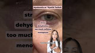 Does your eyelid twitch short shorts healthtips lifehacks healthyliving symptoms eyes [upl. by Sheets]