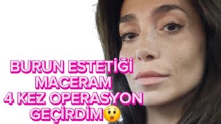 BURUN ESTETİĞİ MACERAM 4 KEZ OPERASYON GEÇİRDİM [upl. by Asteria]